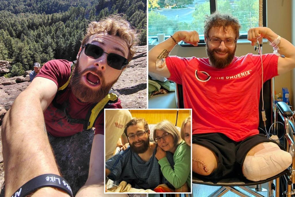 Colorado employee, John O’Neill, has each legs amputated after wooden chipper accident