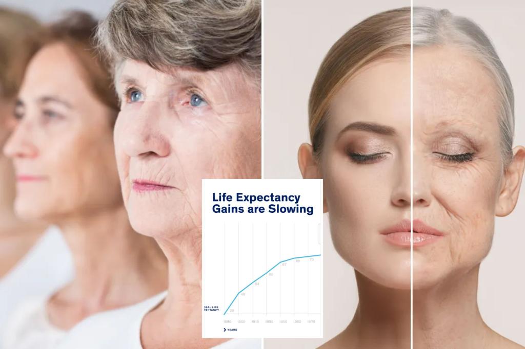 Life expectancy positive aspects have waned regardless of medical breakthroughs