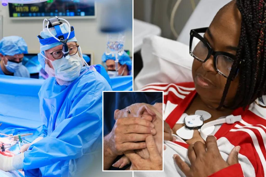 Alabama lady Towana Looney thriving after being the one particular person on the planet with a functioning pig organ