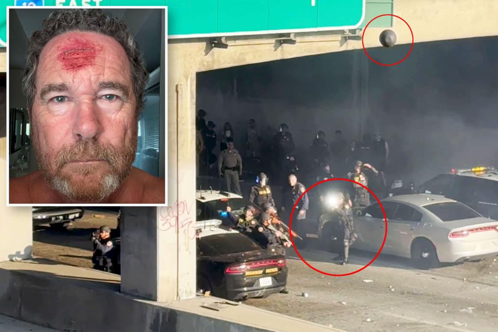 Put up photographer shot with rubber bullet in LA riots