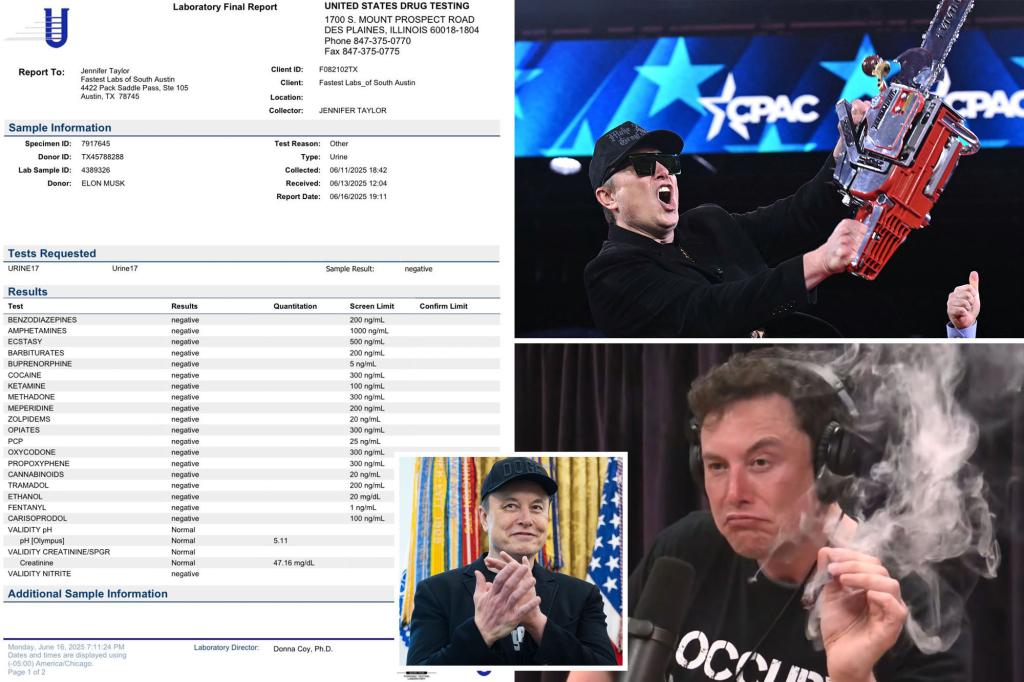 Elon Musk posts purported drug take a look at outcomes to show he isn’t excessive out of his thoughts: ‘lol’