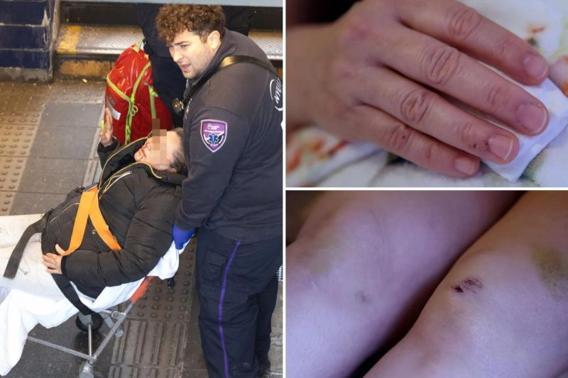 Lady shoved onto NYC subway tracks by crazed attacker slams Mamdani’s security plan